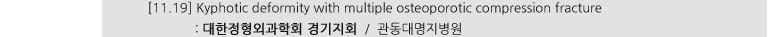 [11.19] Kyphotic deformity with multiple osteoporotic compression fracture : 대한정형외과학회 경기지회 / 관동대명지병원